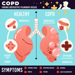 COPD Lung analysis